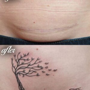 Tattoo Ideas for C Section Scar