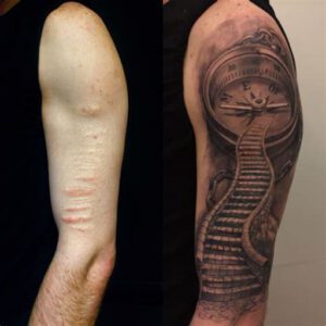 Tattoo Ideas for Scars on Arms